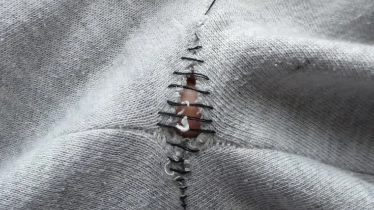 How To Fix Hole in Sweatpants?